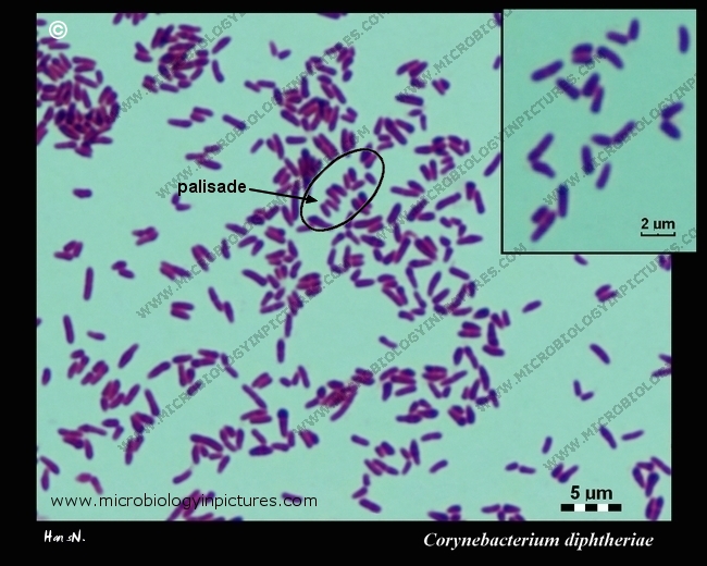 corynebacterium diphtheriae Gram stain, micrograph